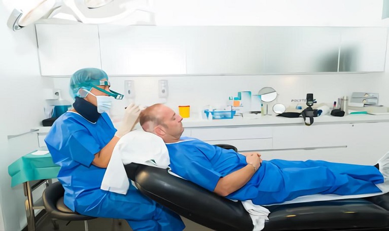 hair transplant