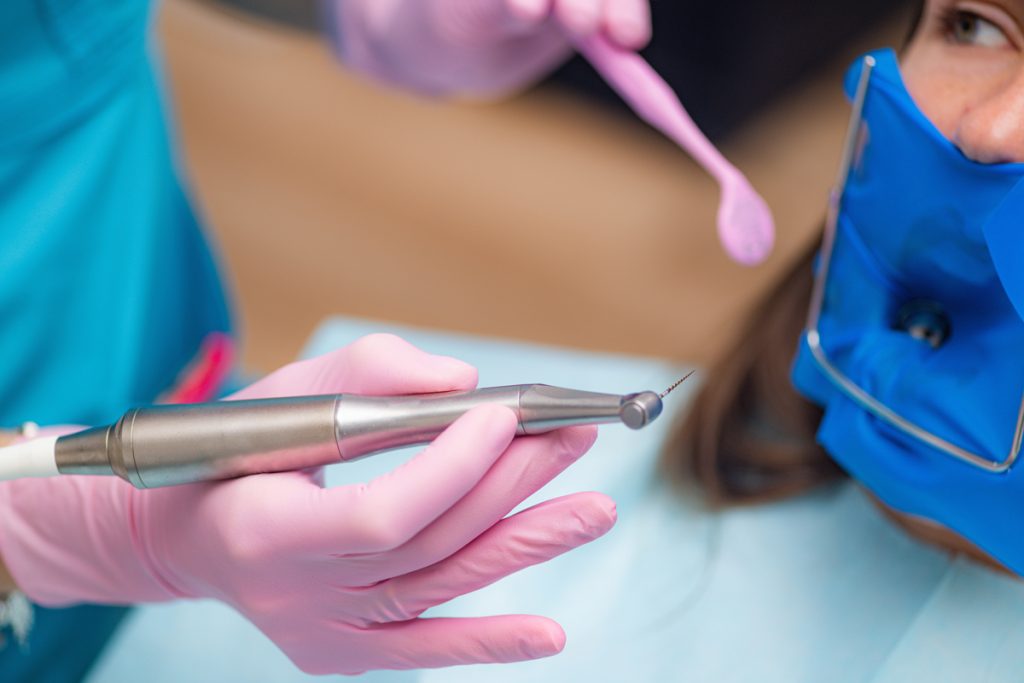 root canal in teeth