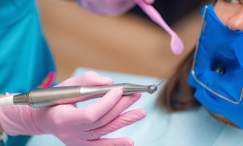root canal in teeth