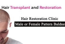 Hair restoration clinic- Hair Restoration Clinic For Male or Female Pattern Baldness