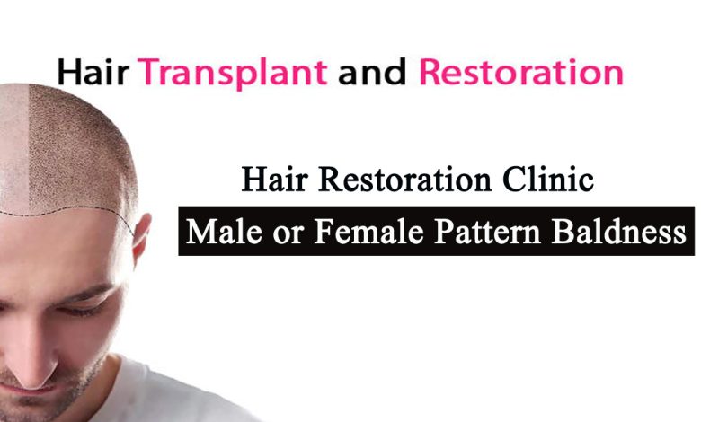 Hair restoration clinic- Hair Restoration Clinic For Male or Female Pattern Baldness