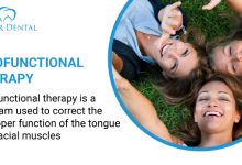 myofunctional thQerapy